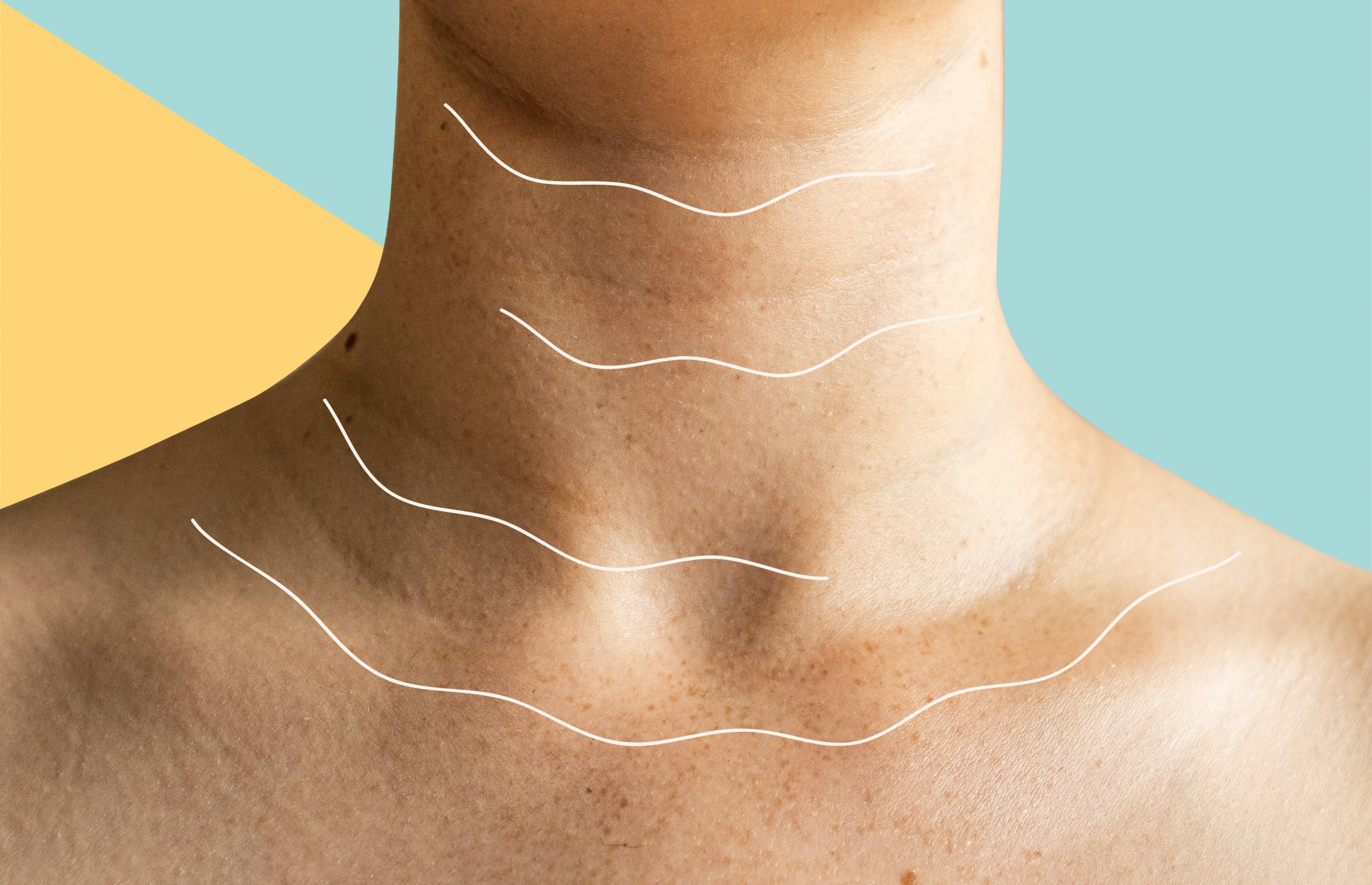 How to Get Rid of Tech Neck Lines